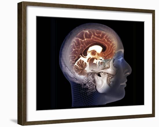 Human Brain, MRI Scan-null-Framed Photographic Print