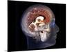 Human Brain, MRI Scan-null-Mounted Photographic Print