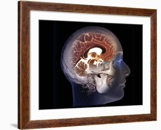 Human Brain, MRI Scan-null-Framed Photographic Print