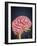 Human Brain with Nerves-Stocktrek Images-Framed Art Print