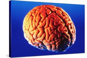 Human Brain-Volker Steger-Stretched Canvas