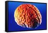 Human Brain-Volker Steger-Framed Stretched Canvas