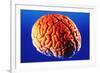 Human Brain-Volker Steger-Framed Photographic Print