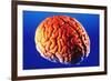 Human Brain-Volker Steger-Framed Photographic Print