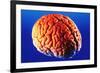 Human Brain-Volker Steger-Framed Photographic Print