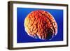 Human Brain-Volker Steger-Framed Photographic Print