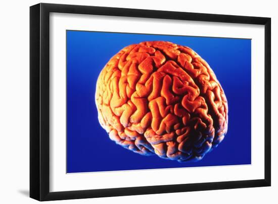 Human Brain-Volker Steger-Framed Photographic Print