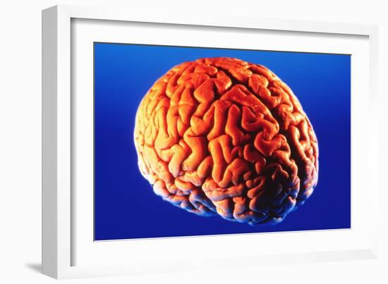 Human Brain-Volker Steger-Framed Photographic Print