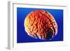 Human Brain-Volker Steger-Framed Photographic Print