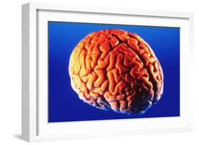 Human Brain-Volker Steger-Framed Photographic Print