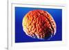 Human Brain-Volker Steger-Framed Photographic Print