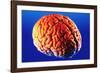 Human Brain-Volker Steger-Framed Photographic Print