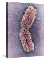 Human Chromosome 1, SEM-Adrian Sumner-Stretched Canvas
