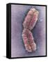 Human Chromosome 1, SEM-Adrian Sumner-Framed Stretched Canvas
