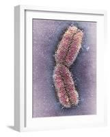 Human Chromosome 1, SEM-Adrian Sumner-Framed Photographic Print