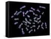 Human Chromosomes-PASIEKA-Framed Stretched Canvas