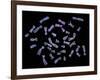 Human Chromosomes-PASIEKA-Framed Photographic Print