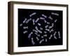 Human Chromosomes-PASIEKA-Framed Photographic Print