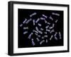 Human Chromosomes-PASIEKA-Framed Photographic Print