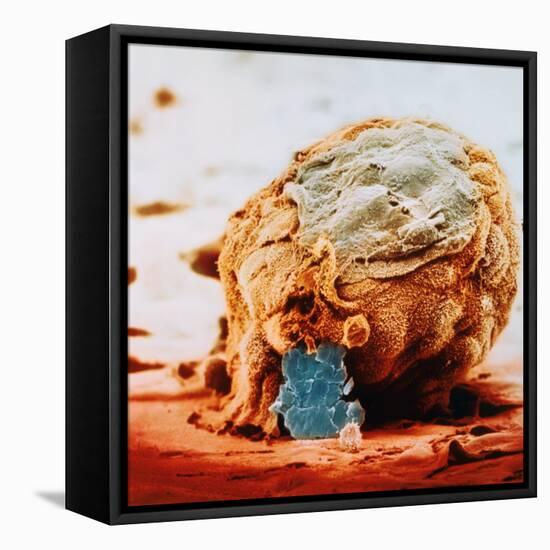 Human Embryo in Early Stages-null-Framed Stretched Canvas