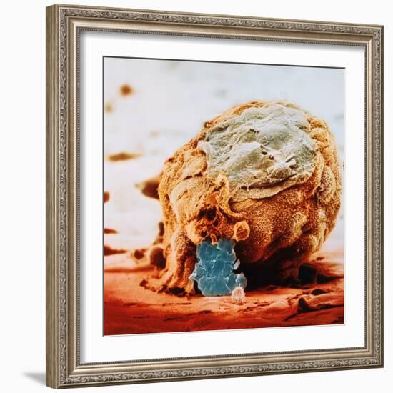 Human Embryo in Early Stages-null-Framed Photographic Print