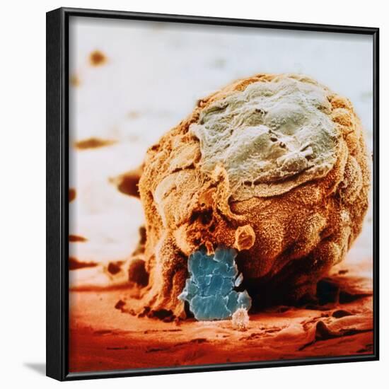 Human Embryo in Early Stages-null-Framed Photographic Print