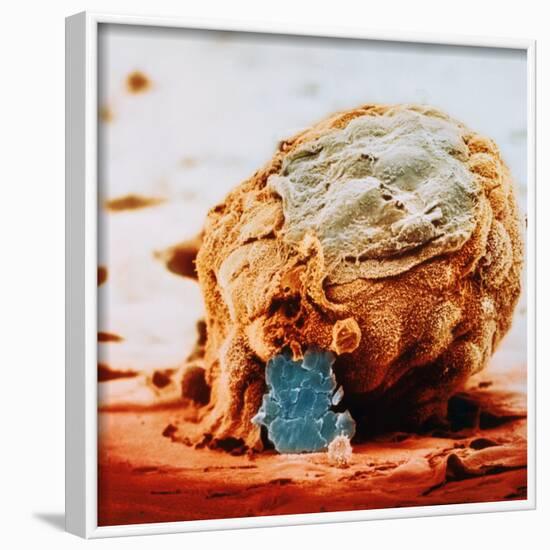 Human Embryo in Early Stages-null-Framed Photographic Print