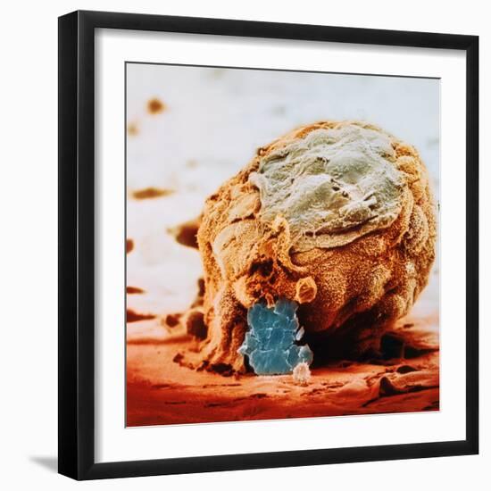 Human Embryo in Early Stages-null-Framed Photographic Print