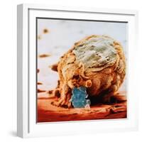 Human Embryo in Early Stages-null-Framed Photographic Print