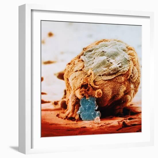 Human Embryo in Early Stages-null-Framed Photographic Print