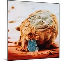 Human Embryo in Early Stages-null-Mounted Photographic Print