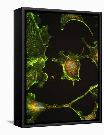Human Epithelial Cells-Riccardo Cassiani-ingoni-Framed Stretched Canvas