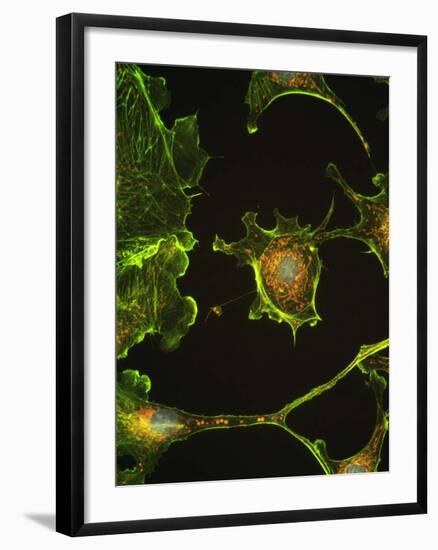 Human Epithelial Cells-Riccardo Cassiani-ingoni-Framed Photographic Print