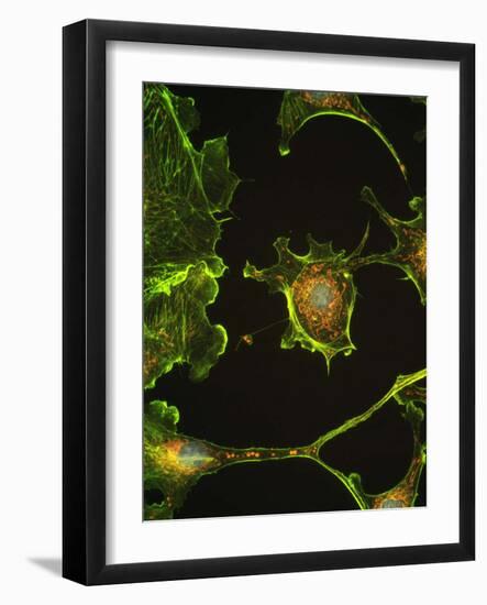 Human Epithelial Cells-Riccardo Cassiani-ingoni-Framed Photographic Print