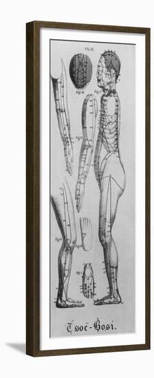 Human Figure Profile with Acupuncture Points and Meridians Identified, 1825-null-Framed Premium Giclee Print