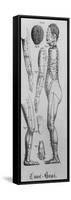 Human Figure Profile with Acupuncture Points and Meridians Identified, 1825-null-Framed Stretched Canvas