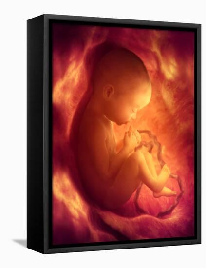 Human Foetus In the Womb, Artwork-Jellyfish Pictures-Framed Stretched Canvas