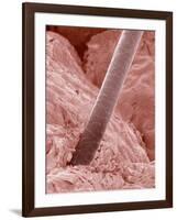 Human Hair and Skin-Micro Discovery-Framed Photographic Print