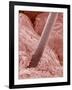 Human Hair and Skin-Micro Discovery-Framed Photographic Print