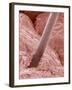 Human Hair and Skin-Micro Discovery-Framed Photographic Print