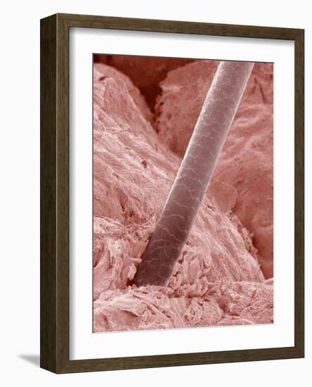 Human Hair and Skin-Micro Discovery-Framed Photographic Print