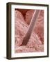 Human Hair and Skin-Micro Discovery-Framed Photographic Print