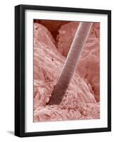 Human Hair and Skin-Micro Discovery-Framed Photographic Print