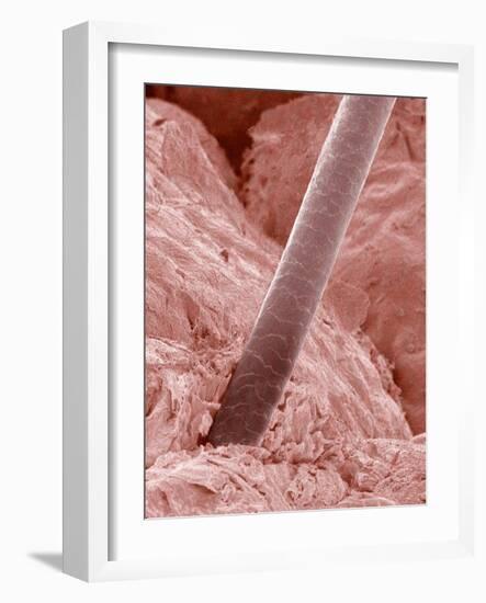 Human Hair and Skin-Micro Discovery-Framed Photographic Print