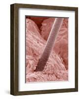 Human Hair and Skin-Micro Discovery-Framed Photographic Print