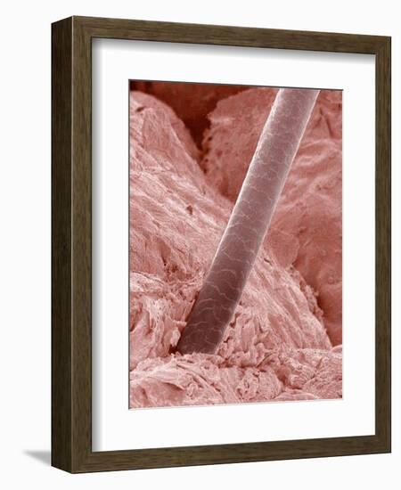Human Hair and Skin-Micro Discovery-Framed Photographic Print