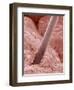Human Hair and Skin-Micro Discovery-Framed Photographic Print