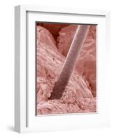 Human Hair and Skin-Micro Discovery-Framed Photographic Print