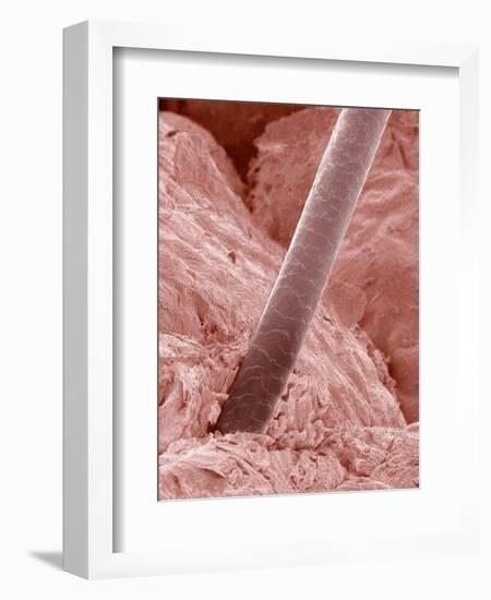 Human Hair and Skin-Micro Discovery-Framed Photographic Print