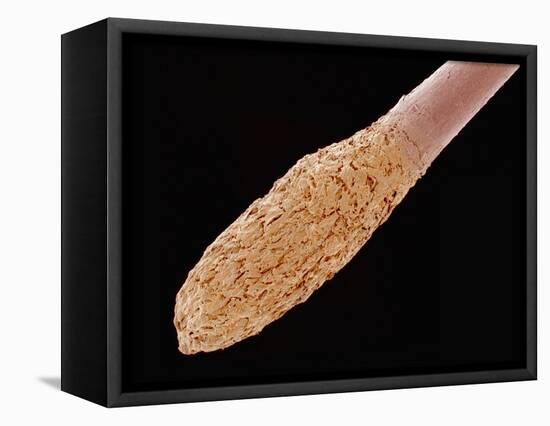 Human Hair Root-Micro Discovery-Framed Stretched Canvas